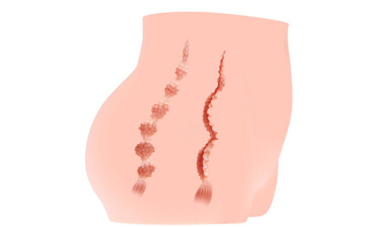 Cherry Masturbator - Image 5