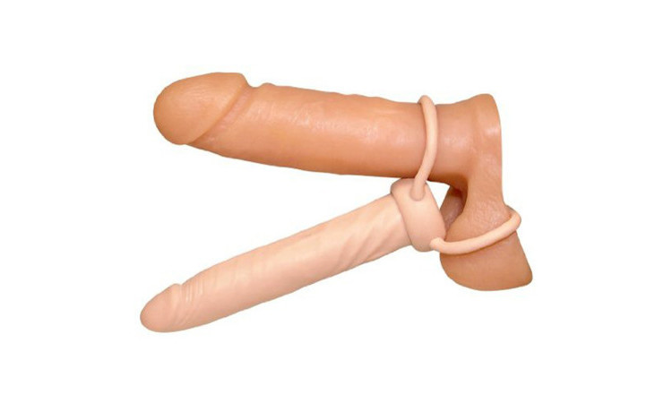 Anal Special nature - Image 2