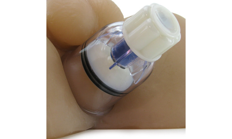 Intake Anal Suction Device - Image 5
